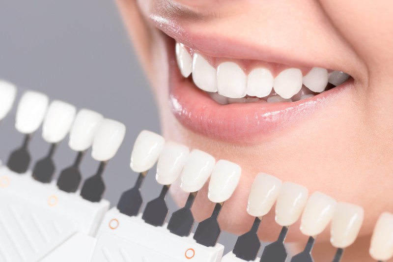 All You Need To Know About Invisalign In Philadelphia